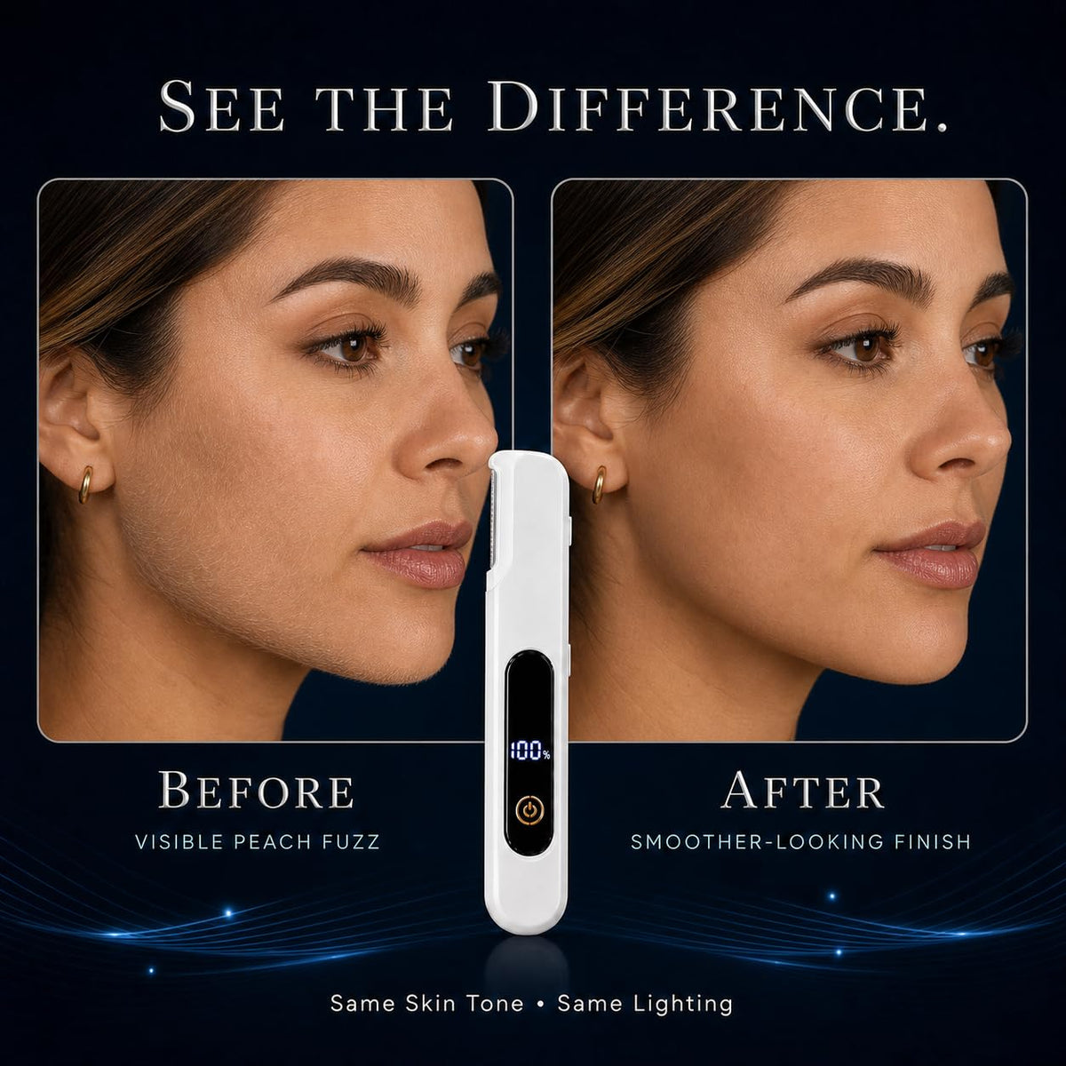 Peach Fuzz Remover I737978